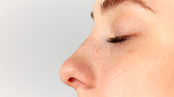 La rhinoplastie : qu’en est-il après l’opération ?